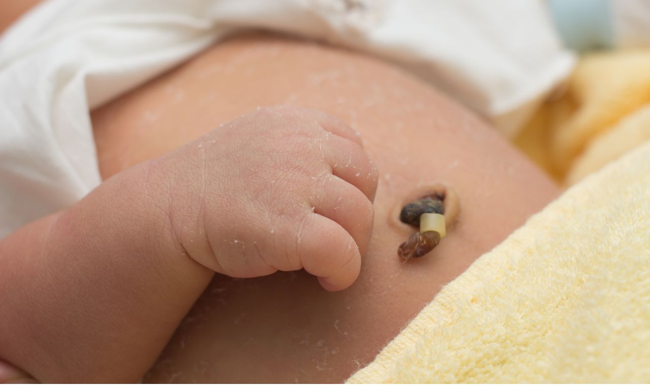 Cordão Umbilical