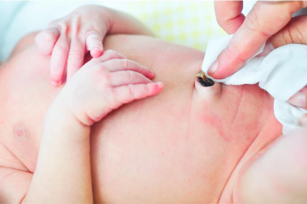 Cordão Umbilical Bebê Recém Nascido