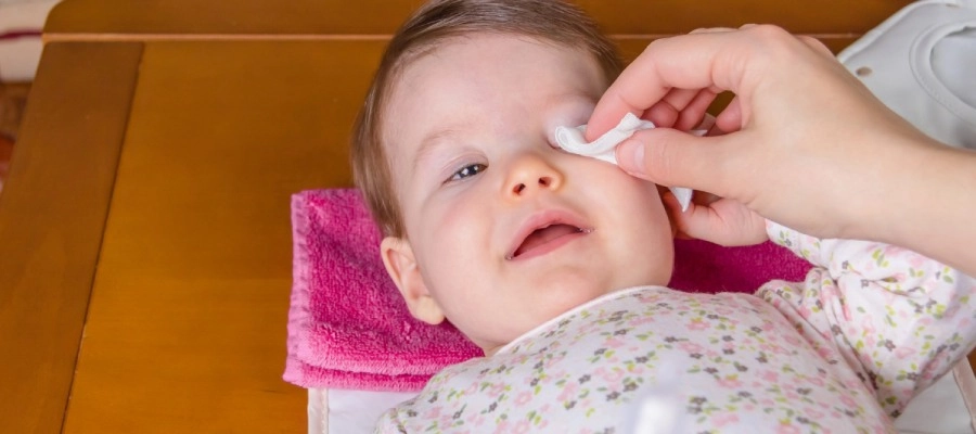 Olhos remelando no bebê