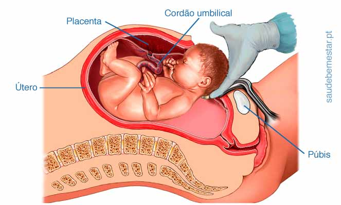 Como é uma cesárea: entenda o procedimento, riscos e cuidados essenciais